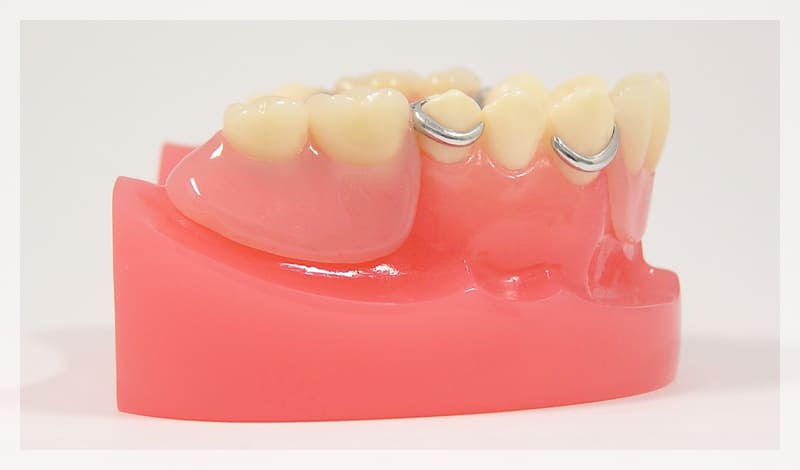 入れ歯の不具合